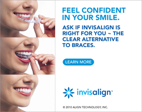 Invisalign